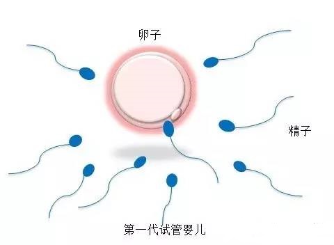 时差成像